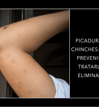 Picaduras de chinches