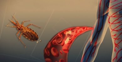 Qué Es La Enfermedad De Chagas (Tripanosomiasis Americana)