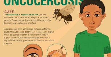 Cómo Prevenir La Oncocercosis - Ceguera De Los Ríos